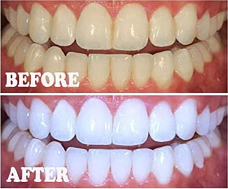 pola naight 16%.jpeg