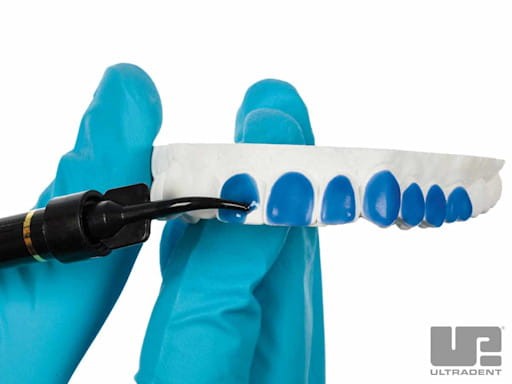 1_Ultradent-LC-Block-Out-Create-Reservoir-Spaces-Clinical.jpg